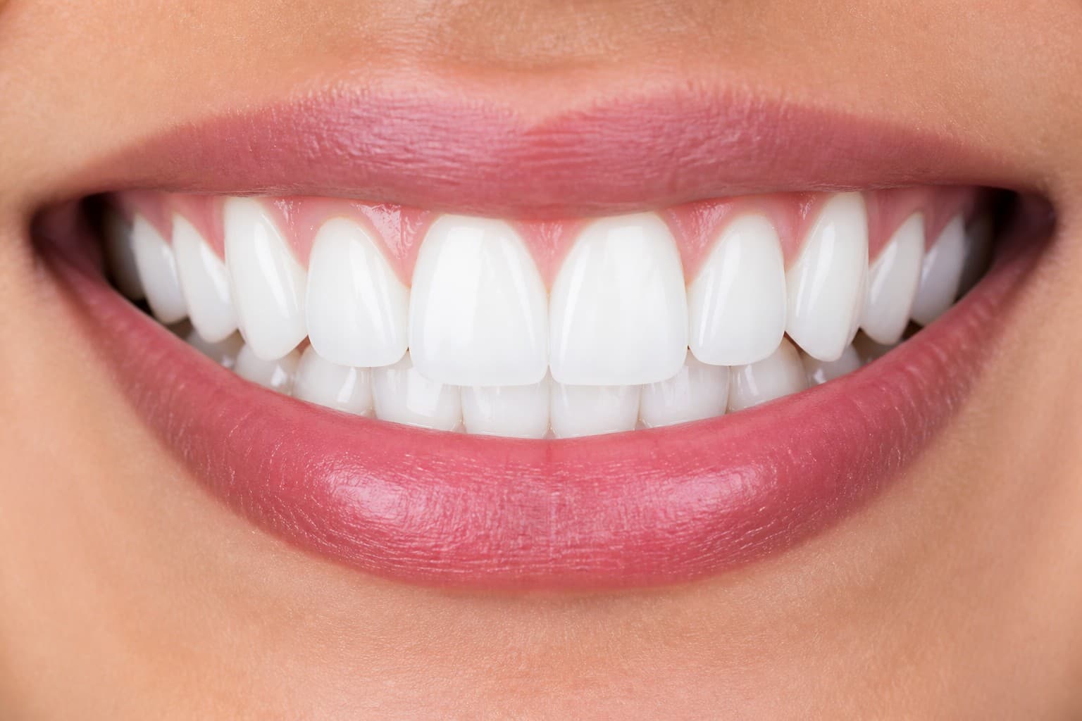 After smile